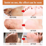 Load image into Gallery viewer, Foot Cream for Cracked and Dry Skin, Heel, Finger Healing Balm and Blaster 200 ml
