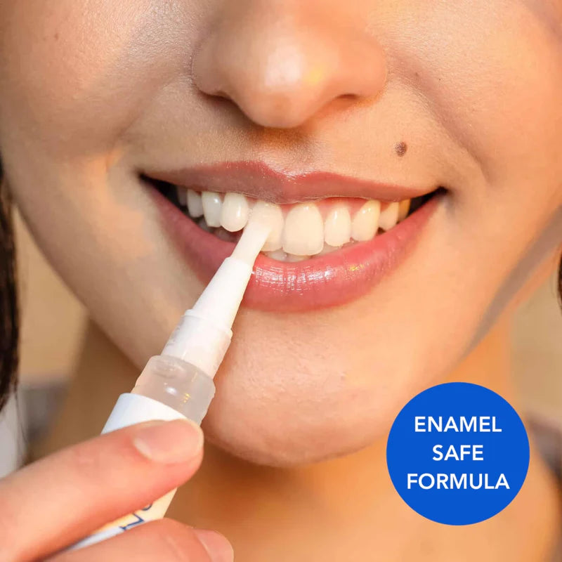 DiamondSeries® Wireless Teeth Whitening Kit with Hydroxyapatite & Self-Sanitizing Charging Case