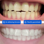 Load image into Gallery viewer, DiamondSeries® Wireless Teeth Whitening Kit with Hydroxyapatite &amp; Self-Sanitizing Charging Case
